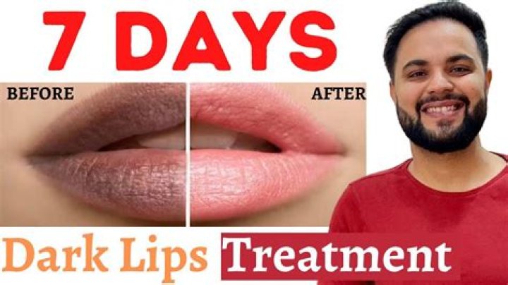 Can I tan my lips?