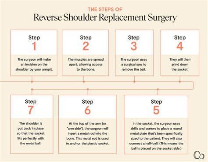Can you reach behind your back after reverse shoulder replacement?