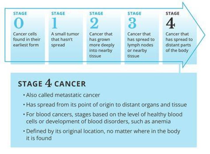 How Long Can You Live on Stage 4?