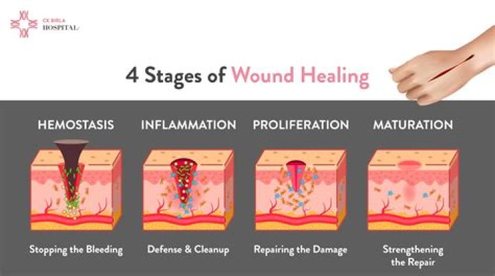 How long does it take an incision to heal?