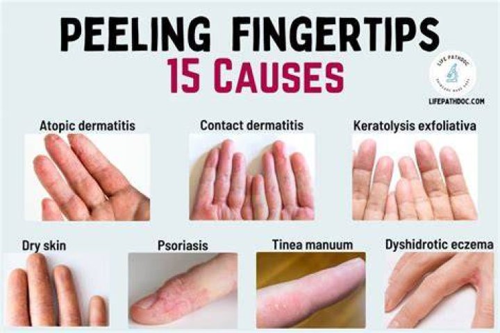 How much bacteria is between your fingertips and elbows?