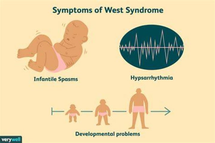 Is West syndrome terminal?