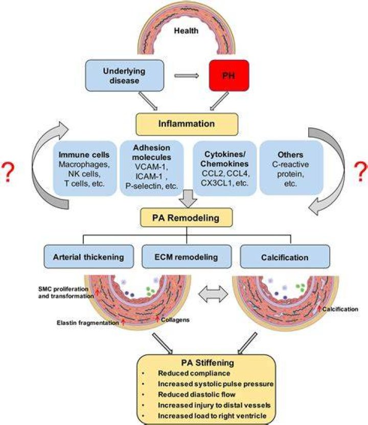 Should I exercise with inflammation?