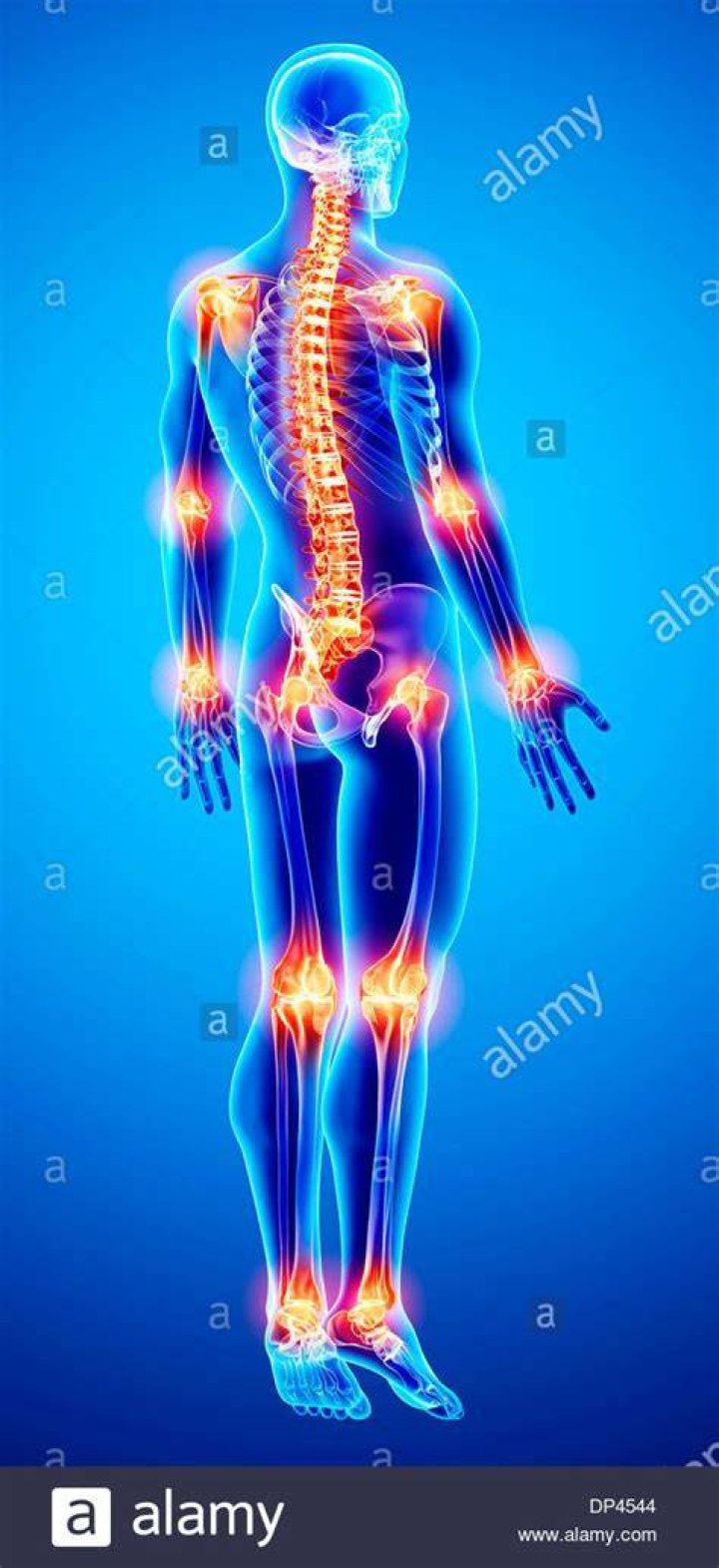 What can cause sudden all over joint pain?