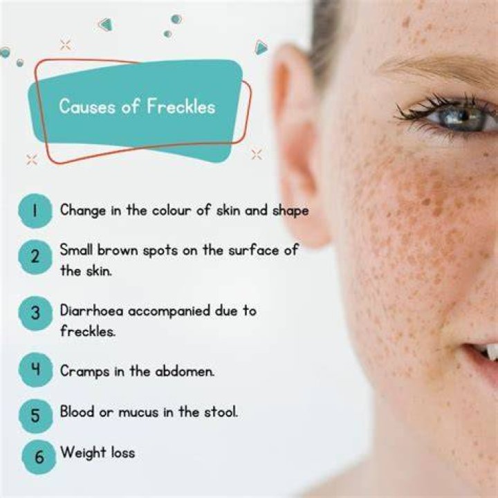What causes you to get freckles?