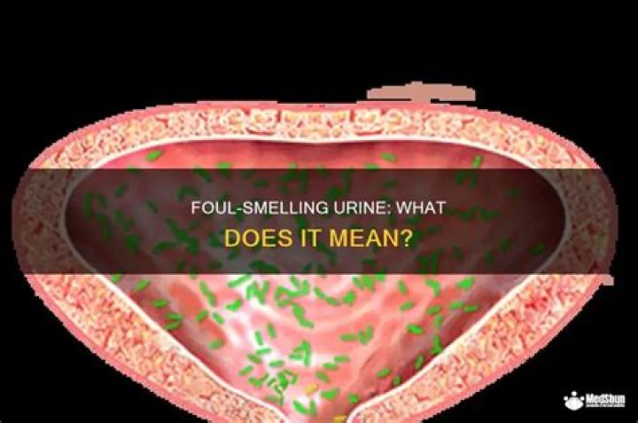 What does foul smelling diarrhea mean?