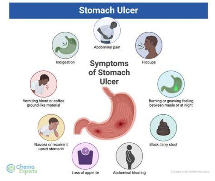 What is stomach ulcer pain like?