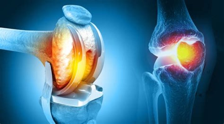 What is the most painful joint replacement?
