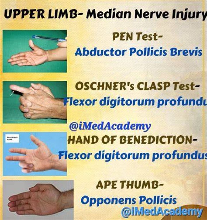 What test determines median nerve injury?