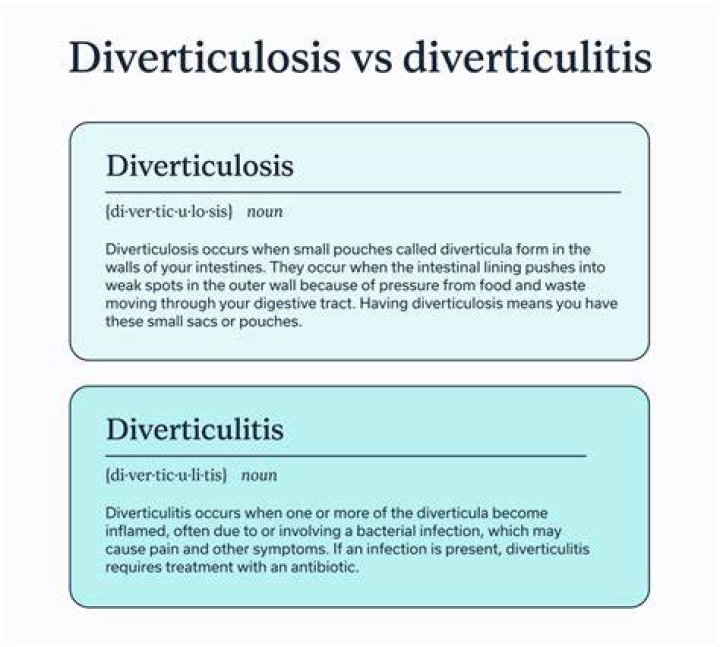 Which one is worse diverticulitis or diverticulosis?