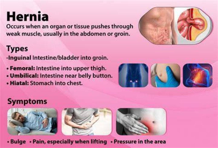 Why does my hernia make a gurgling sound?
