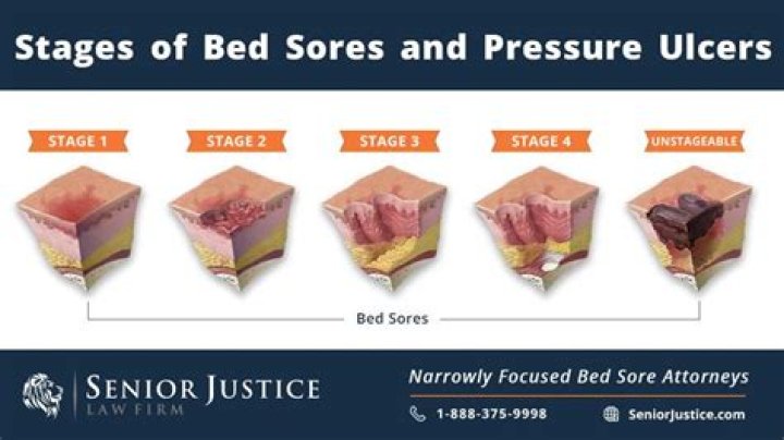 Why would a bed sore turn black?